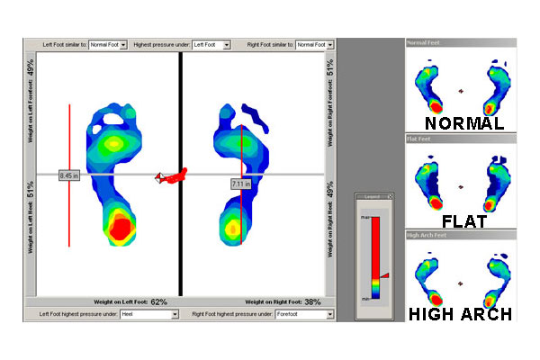 Tekscan-Whitby-Physio